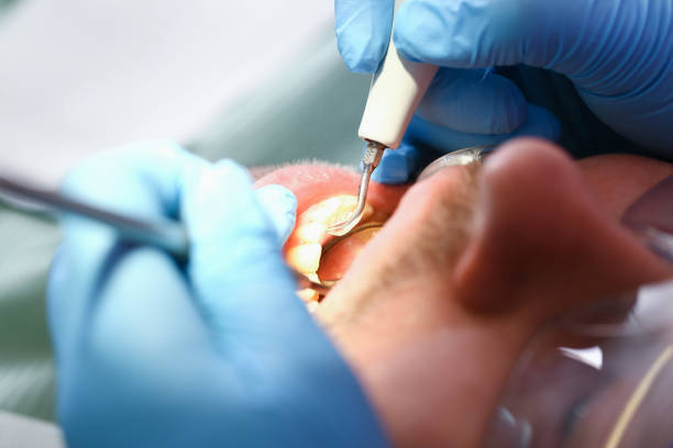 Best Broken or Cracked Tooth Emergency Dentist in Marion, TX